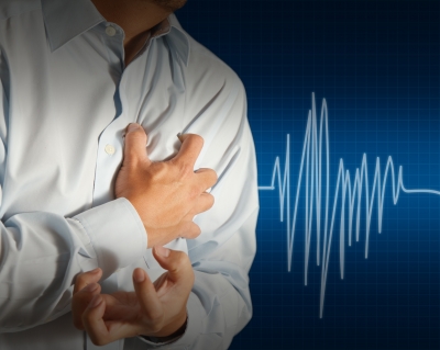 hipertenzijos aritmija sukelia ar kas nors gali įveikti hipertenziją