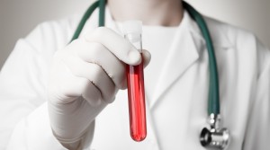Doctor holding a bottle of blood sample